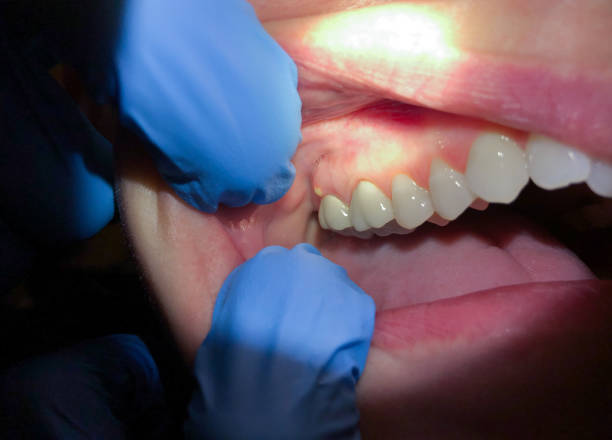 Best Orthodontic Emergency Dentist in Macon, MS